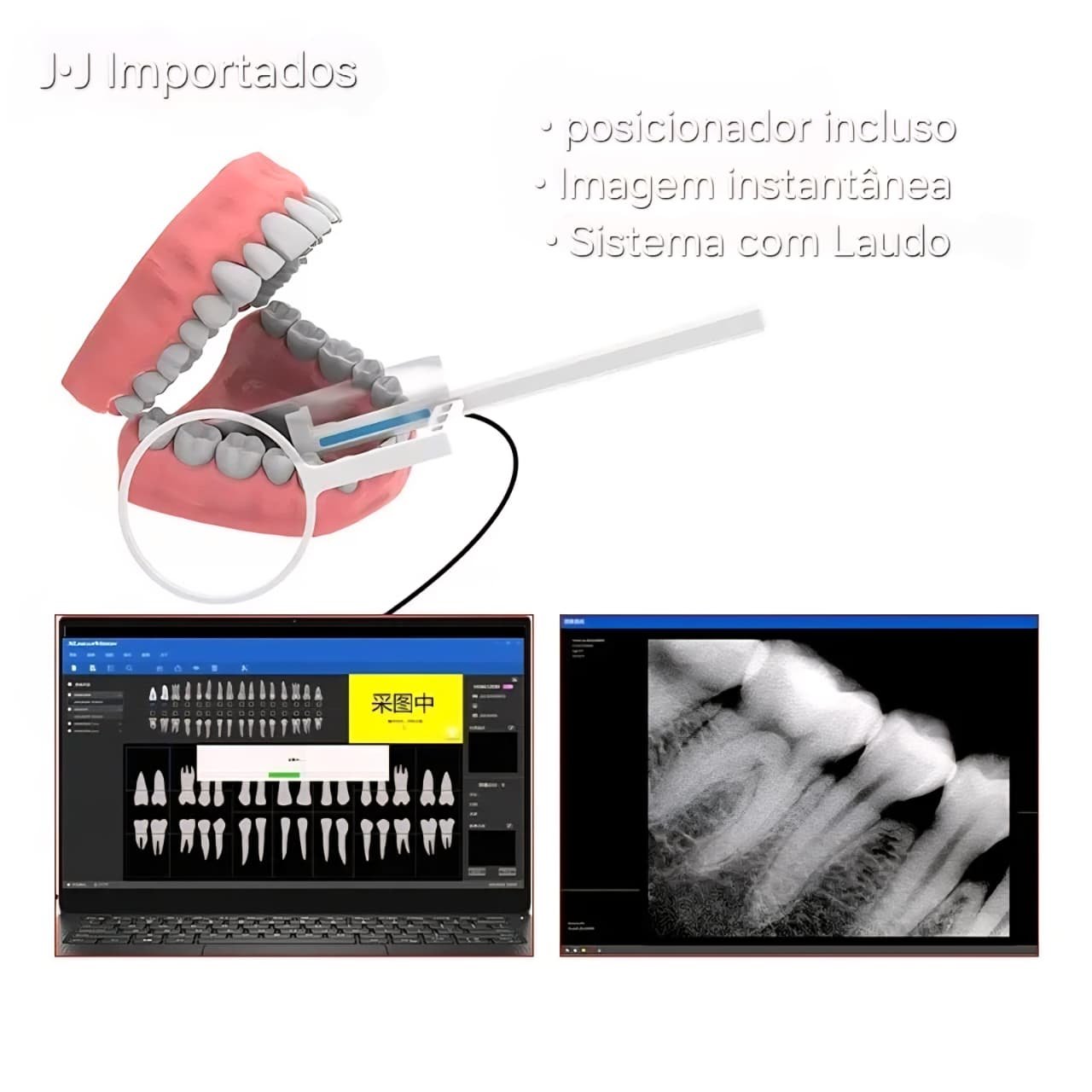 Kit completo Sensor JJ Importados